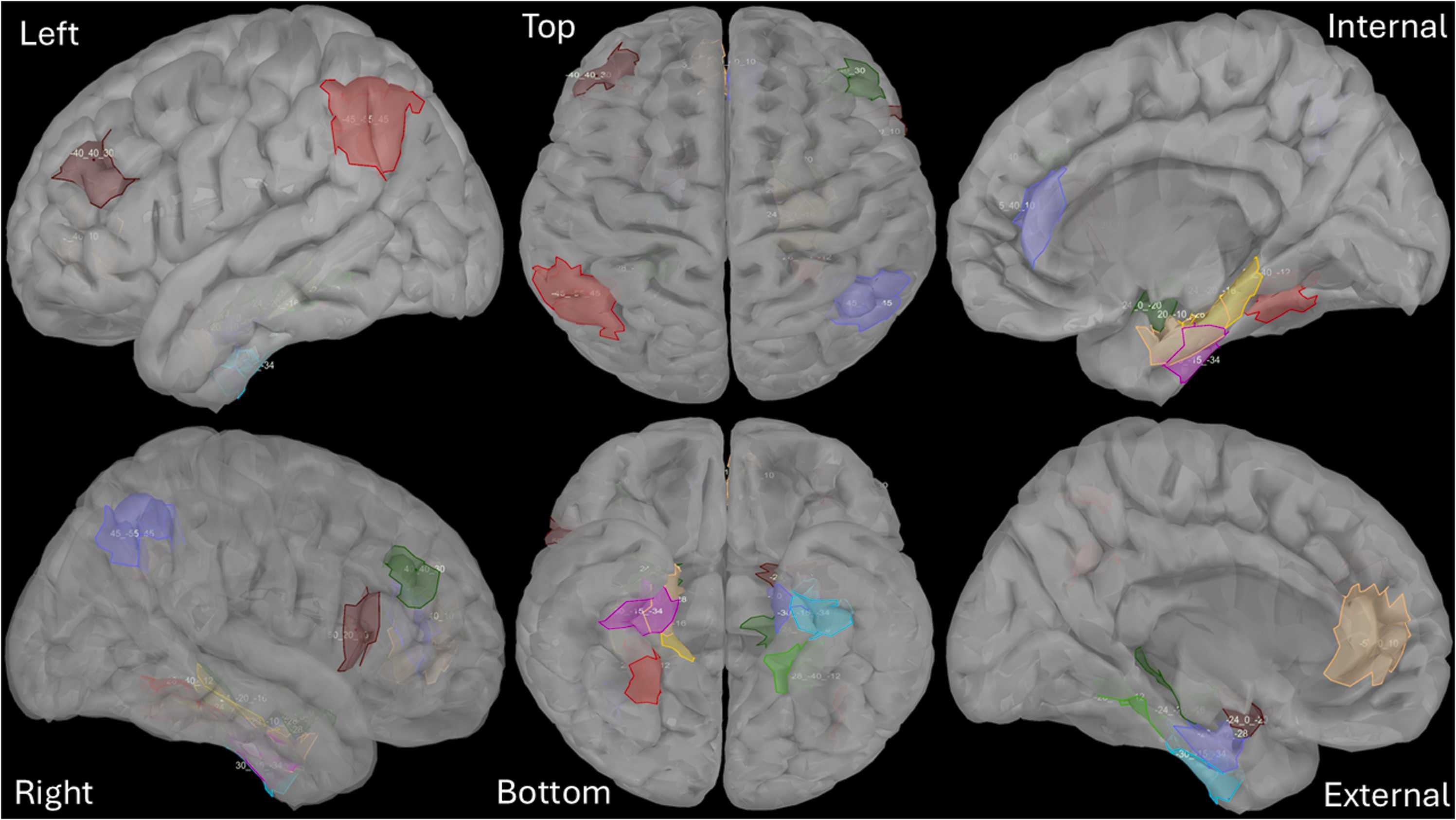Harmony in the brain – Surtil